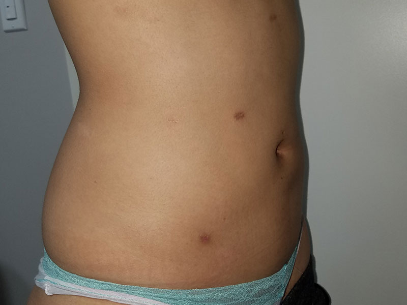 Lipos3-8