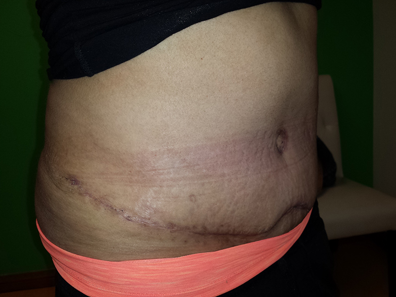 Tummy-4